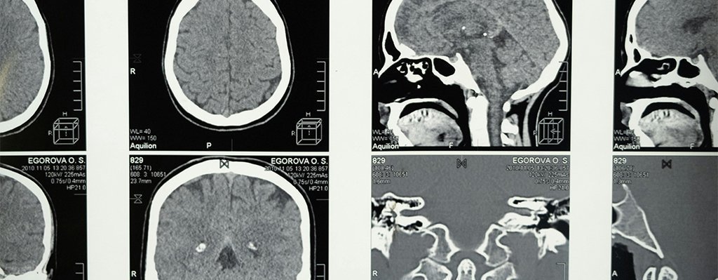 Curso de anatomía humana forense