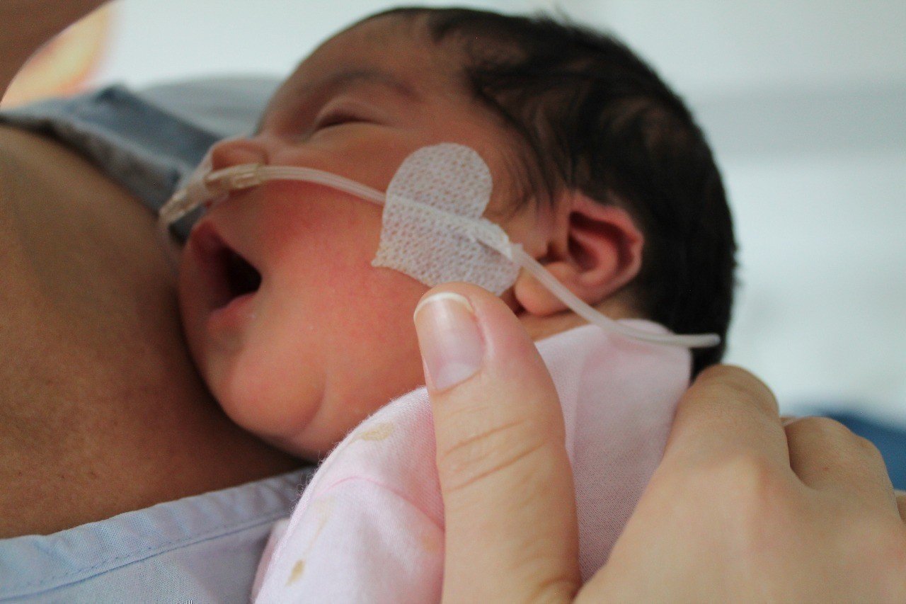 Paciente de la unidad neonatal- Clínica Universitaria Bolivariana